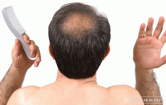 Will there be no baldness: how to know in advance and prevent hair loss in men
