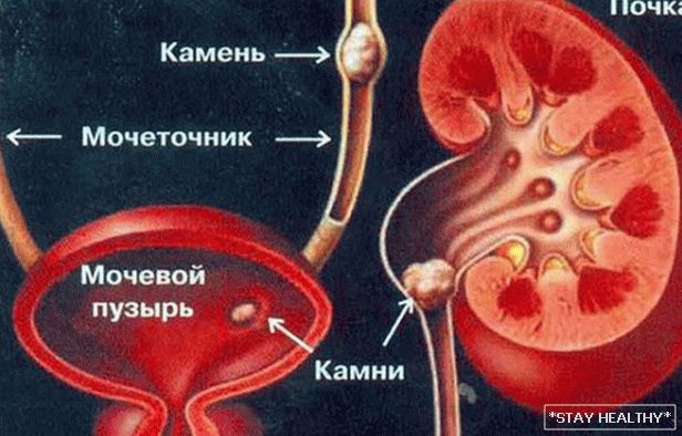 Diet for IBD kidney