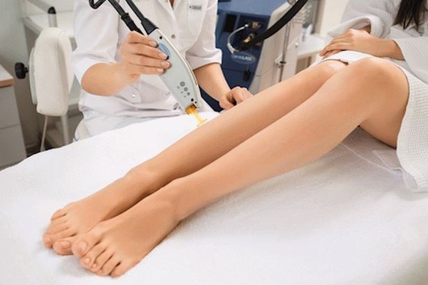 diode laser hair removal