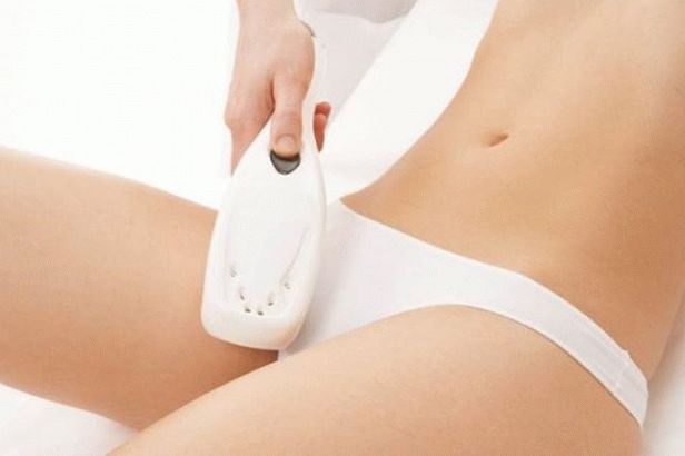 How to prepare for laser hair removal