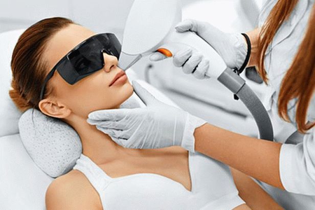 How to prepare for laser hair removal