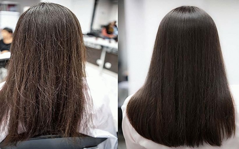 which treatments are best for hair