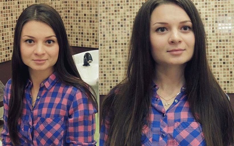 which treatments are best for hair