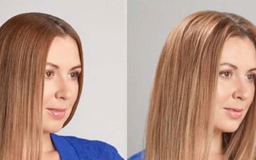 which treatments are best for hair
