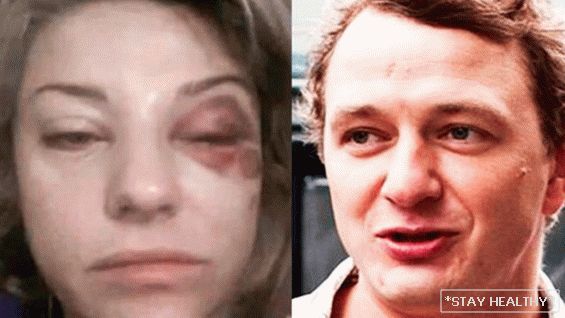 Marat Basharova's wife forgave him assault